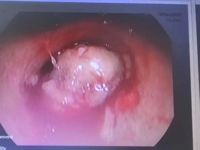 微信图片_2025-12-24_142305_372 微信图片_2025-12-24_142305_372