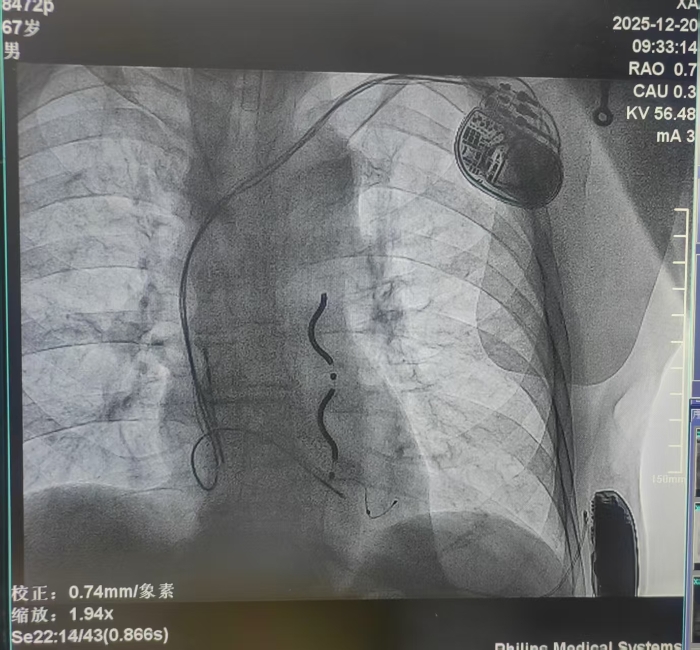 微信图片_2025-12-25_162814_520.jpg 微信图片_2025-12-25_162814_520.jpg