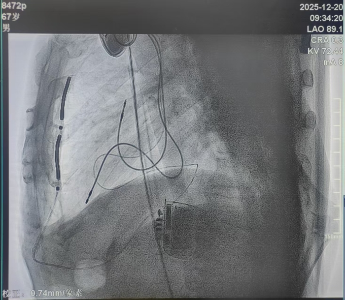 微信图片_2025-12-25_162810_880.jpg 微信图片_2025-12-25_162810_880.jpg