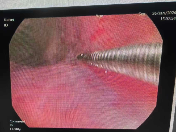 微信图片_20260127185709_336_197.jpg 微信图片_20260127185709_336_197.jpg