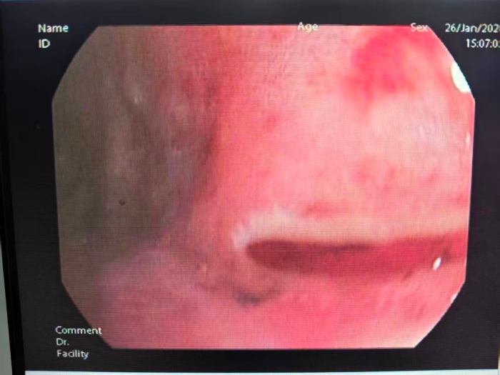 微信图片_20260127185710_337_197.jpg 微信图片_20260127185710_337_197.jpg