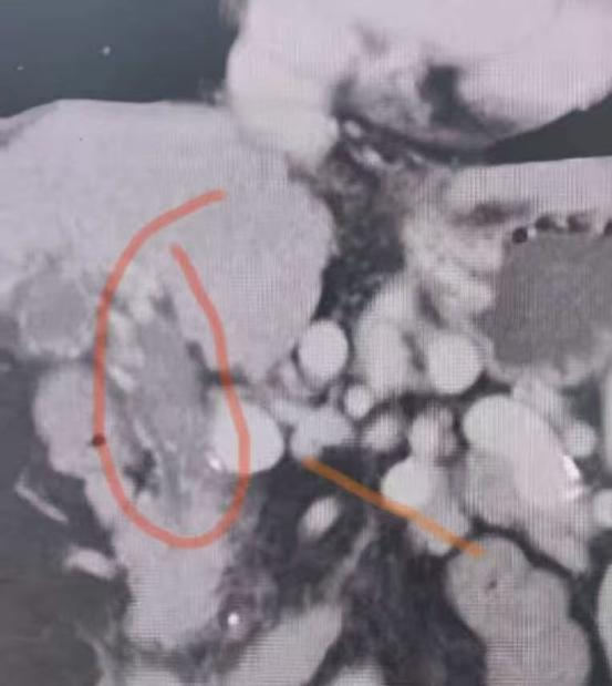 微信图片_2026-03-03_083424_136 微信图片_2026-03-03_083424_136