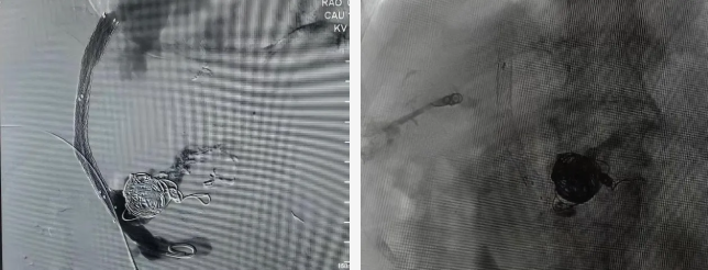 ScreenShot_2026-03-03_083551_071 ScreenShot_2026-03-03_083551_071